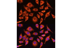 Immunofluorescence analysis of L929 cells using PPP1R15A Rabbit pAb (ABIN7269676) at dilution of 1:100. (GADD34 antibody  (AA 375-674))