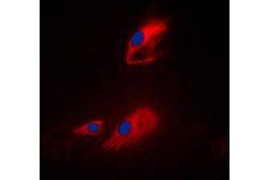 Immunofluorescent analysis of ACOT8 staining in Raji cells. (ACOT8 antibody  (Center))