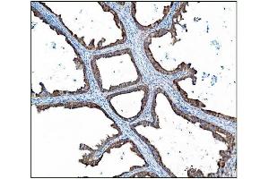 IHC analysis of AS160/TBC1D4 using anti-AS160/TBC1D4 antibody (ABIN7599745). (TBC1D4 antibody  (AA 1118-1298))