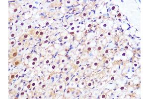 Immunohistochemistry of paraffin-embedded rat ovary using PSM Rabbit mAb (ABIN7269600) at dilution of 1:100 (40x lens). (PSMA3 antibody)