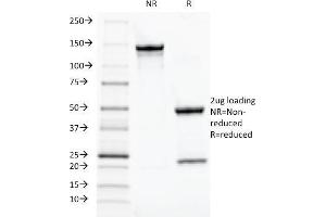SDS-PAGE Analysis Purified TOX3 Mouse Monoclonal Antibody (TOX3/1124). (TOX3 antibody  (AA 251-389))