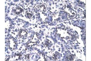 Image no. 1 for anti-Forkhead Box P1 (FOXP1) (AA 223-270) antibody (ABIN202867) (FOXP1 antibody  (AA 223-270))