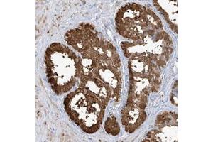 Immunohistochemical staining of human liver with TGM4 polyclonal antibody  shows strong cytoplasmic positivity in glandular cells. (TGM4 antibody)