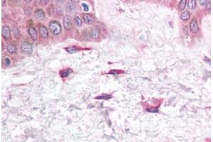 Human Skin, Fibroblasts (formalin-fixed, paraffin-embedded) stained with CXCL12 antibody ABIN214748 at 5 ug/ml followed by biotinylated goat anti-rabbit IgG secondary antibody ABIN481713, alkaline phosphatase-streptavidin and chromogen. (CXCL12 antibody  (C-Term))