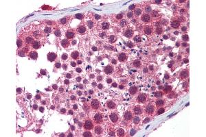 Immunohistochemistry (IHC) image for anti-Histone Deacetylase 6 (HDAC6) (N-Term) antibody (ABIN2779558) (HDAC6 antibody  (N-Term))