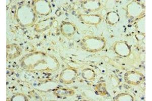 Immunohistochemistry of paraffin-embedded human kidney tissue using ABIN7175476 at dilution of 1:100 (VAMP3 antibody  (AA 1-80))