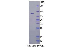 SDS-PAGE analysis of Rat VNN1 Protein. (VNN1 Protein)