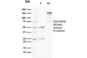 SDS-PAGE Analysis Purified PAPP-A Mouse Monoclonal Antibody (PAPPA/2716).