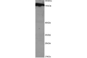 Image no. 1 for anti-Damage Specific DNA Binding Protein 1 (DDB1) (C-Term) antibody (ABIN374069) (DDB1 antibody  (C-Term))