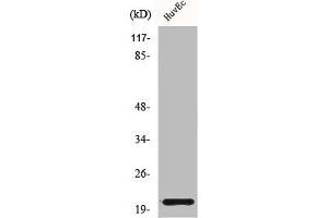 Western Blot analysis of HuvEc cells using Cardiotrophin-1 Polyclonal Antibody (Cardiotrophin 1 antibody  (N-Term))