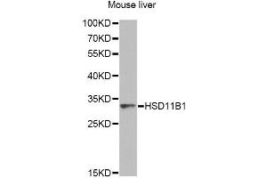Western blot analysis of extracts of mouse liver, using HSD11B1 antibody. (HSD11B1 antibody)