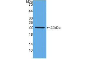 Figure. (IFNB1 antibody  (AA 27-203))