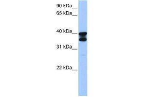 SLC25A31 antibody used at 1 ug/ml to detect target protein. (SLC25A31 antibody)