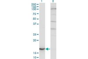 Western Blot analysis of CYB5A expression in transfected 293T cell line by CYB5A monoclonal antibody (M06A), clone 1A8. (CYB5A antibody  (AA 1-134))