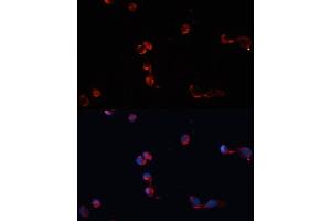 Immunofluorescence analysis of HeLa cells using Catalasealase antibody (ABIN6133450, ABIN6137987, ABIN6137989 and ABIN6215464) at dilution of 1:100. (Catalase antibody  (AA 1-225))