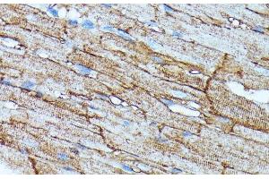 Immunohistochemistry of paraffin-embedded Rat heart using SLC14A1 Polyclonal Antibody at dilution of 1:100 (40x lens). (SLC14A1 antibody)
