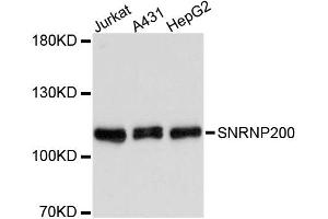 Western blot analysis of extracts of various cell lines, using SNRNP200 antibody (ABIN1877090) at 1:3000 dilution. (SNRNP200 antibody)