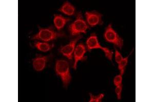 ABIN6268996 staining Hela by IF/ICC. (PRKACA antibody  (Internal Region))