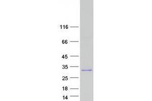 Validation with Western Blot (PROC Protein (Transcript Variant 1) (Myc-DYKDDDDK Tag))