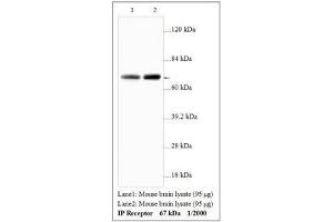 Image no. 1 for anti-Prostacyclin Receptor (PTGIR) antibody (ABIN791360)