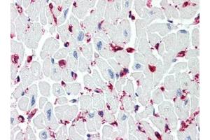 Human Heart (formalin-fixed, paraffin-embedded) stained with SIRT2at 5 µg/ml followed by biotinylated goat anti-rabbit IgG secondary antibody, alkaline phosphatase-streptavidin and chromogen. (SIRT2 antibody  (C-Term))