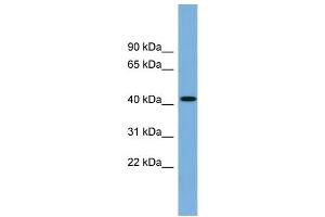 WB Suggested Anti-WDFY1 Antibody Titration: 0. (WDFY1 antibody  (N-Term))