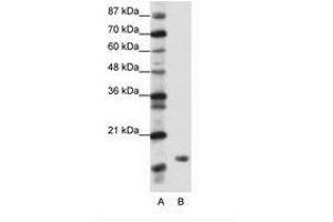 Image no. 1 for anti-TATA-Binding Protein-Associated Phosphoprotein (DR1) (N-Term) antibody (ABIN202041) (DR1 antibody  (N-Term))