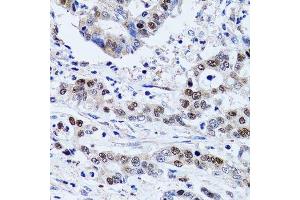 Immunohistochemistry (Paraffin-embedded Sections) (IHC (p)) image for anti-Ubiquitin-Like, Containing PHD and RING Finger Domains, 1 (UHRF1) (AA 1-260) antibody (ABIN3023232)