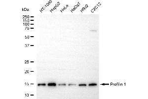 anti-Profilin 1 (PFN1) antibody