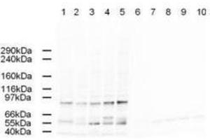 Western blot using  Affinity Purified anti-AP2A antibody shows detection of a band just below 100 kDa correspond-ing to Human AP2A1 in a various preparations. (alpha Adaptin antibody  (AA 3-14))