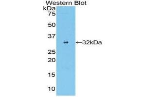 Western Blotting (WB) image for anti-Oncostatin M Receptor (OSMR) (AA 513-760) antibody (ABIN3206107) (Oncostatin M Receptor antibody  (AA 513-760))