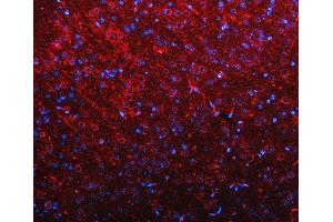 IF analysis of RIMBP2 using anti-RIMBP2 antibody (ABIN7601441). (RIMBP2 antibody  (AA 351-1049))