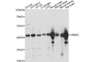 Western blot analysis of extracts of various cell lines, using GNAQ antibody. (GNAQ antibody)