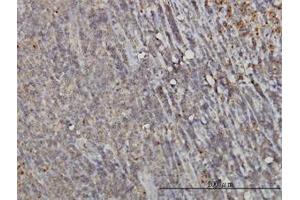 Image no. 1 for anti-RAB6A, Member RAS Oncogene Family (RAB6A) (AA 109-208) antibody (ABIN598568) (RAB6A antibody  (AA 109-208))