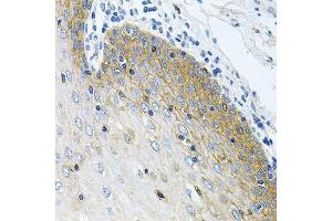 Immunohistochemistry of paraffin-embedded human esophagus using GNE antibody. (GNE antibody  (AA 1-150))