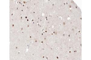 ABIN6266561 at 1/100 staining human brain tissue sections by IHC-P. (HDAC9 antibody  (C-Term))