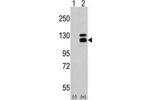 Western blot analysis of Parg Antibody (C-term) in 293 cell line lysates (35 µg/lane). (PARG antibody  (C-Term))