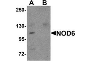 Western blot analysis of NOD6 in EL4 cell lysate with NOD6 antibody at 1 μg/ml in the (A) absence and (B) presence of blocking peptide. (NLRP9 antibody  (N-Term))