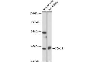 Western blot analysis of extracts of various cell lines, using SOX18 antibody (ABIN7270572) at 1:1000 dilution. (SOX18 antibody  (AA 1-100))