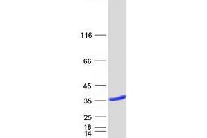 Western Blotting (WB) image for Lectin, Galactoside-Binding, Soluble, 8 (LGALS8) (Transcript Variant 2) protein (Myc-DYKDDDDK Tag) (ABIN2721647)