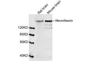 Western blot analysis of tissue lysates using 1 µg/mL Rabbit Anti-Neurofascin Polyclonal Antibody (ABIN398840) The signal was developed with IRDyeTM 800 Conjugated Goat Anti-Rabbit IgG.