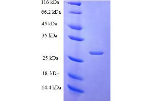 SDS-PAGE (SDS) image for Zinc Ribbon Domain Containing 1 (ZNRD1) (AA 1-126), (full length) protein (His-SUMO Tag) (ABIN5711917)