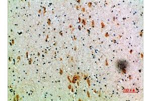 Immunohistochemical analysis of paraffin-embedded human-brain, antibody was diluted at 1:200 (KIR3DL2 antibody  (AA 221-270))