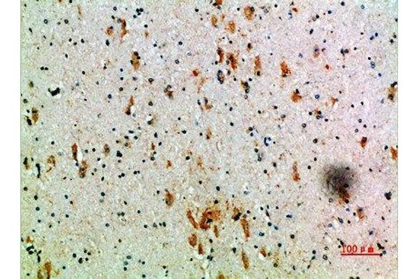 KIR3DL2 antibody  (AA 221-270)