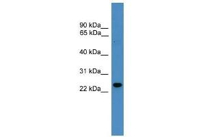 RAB9B antibody used at 0. (RAB9B antibody  (N-Term))