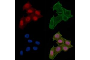 ABIN6257009 and ABIN6274409 staining Hela cells(24h of starvation treatment) by IF/ICC. (MOB1A antibody  (N-Term))