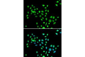 Immunofluorescence analysis of U2OS cells using macroH2A. (H2AFY antibody  (AA 123-372))