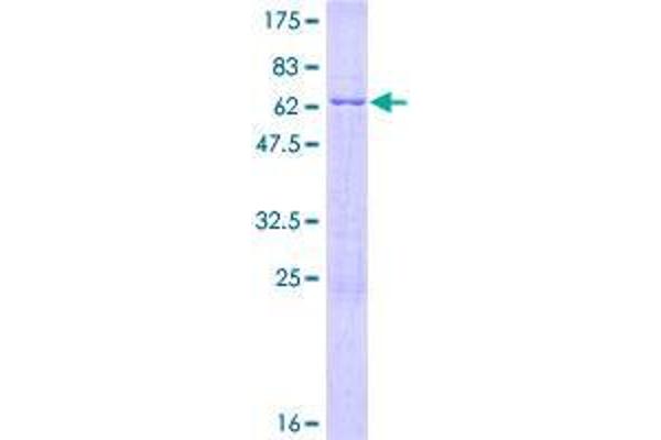 DIMT1 Protein (AA 1-313) (GST tag)