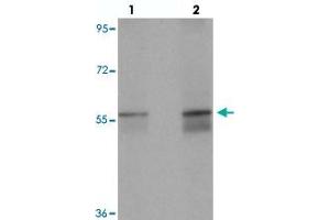 Western blot analysis of NETO1 in human lung tissue with NETO1 polyclonal antibody  at (lane 1) 1 and (lane 2) 2 ug/mL.