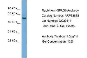 WB Suggested Anti-SPAG6  Antibody Titration: 0. (SPAG6 antibody  (Middle Region))